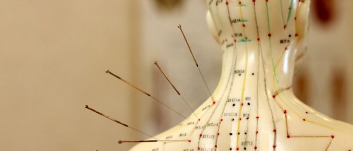 ACUPUNCTURE ACUPUNCTURE