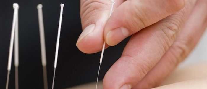 acupuntura_16944_l